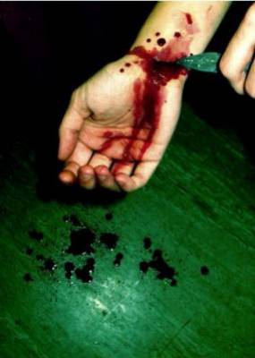 mutilations